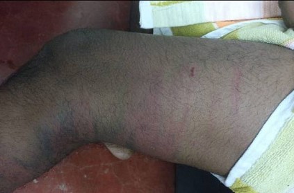 1st-year student ragged by seniors, beaten for 3 hrs