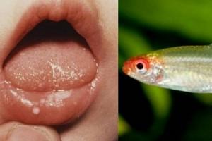 Mother keeps live fish in 5-month-old baby's mouth; Reason will shock you