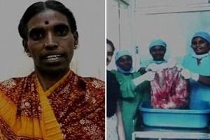 'World's Heaviest Ovarian Cancer Tumour' Removed By Doctors In Coimbatore